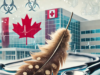 Teenager Hospitalized in Canada’s First Suspected Case of Bird Flu